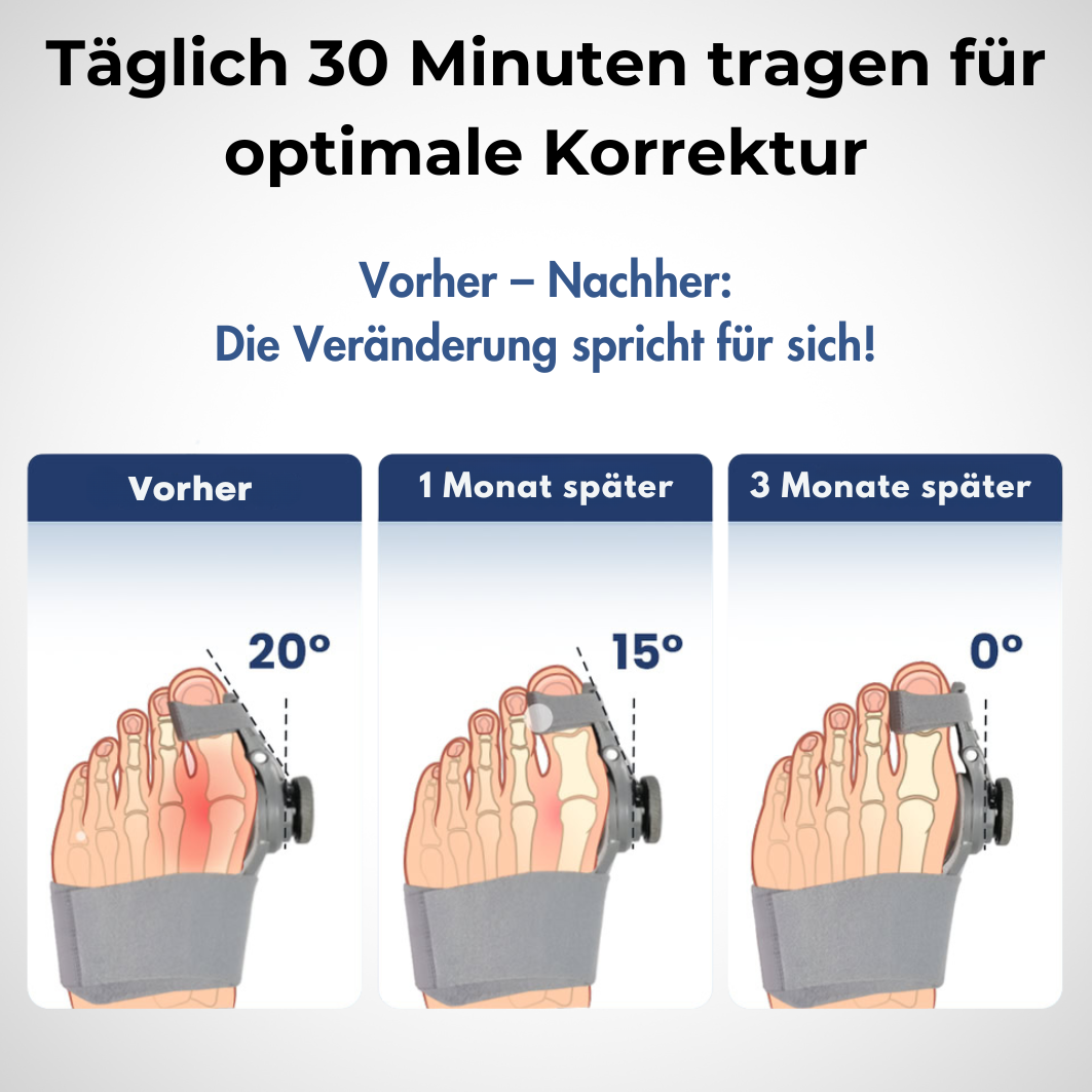 ToeFit™ - Fussstabilisator