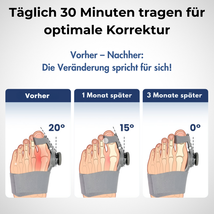 ToeFit™ - Fussstabilisator